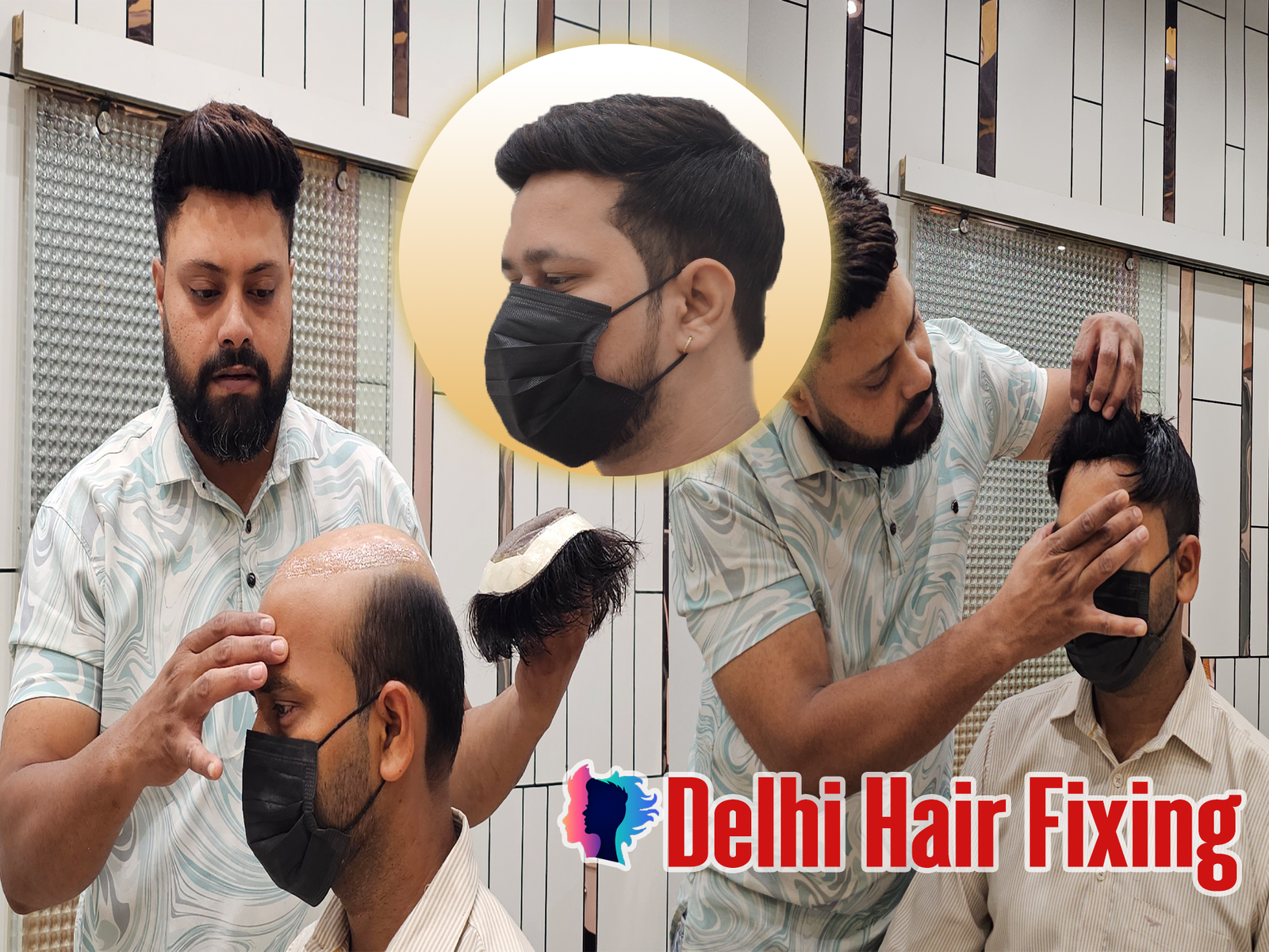 Affordable Hair Patch for Men in Delhi | Real Results by Delhi Hair Fixing